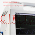 Schiller Defigard 5000緊急心臟電擊除顫器機器用於重振心臟翻新
